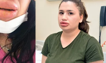 Silikon mağduru sadece Merve Keleş değilmiş!