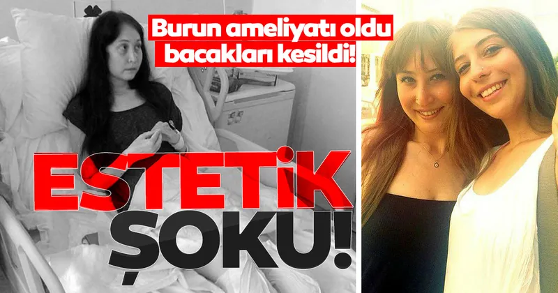 Son Dakika Haberi Bir Estetik Faciasi Daha Burun Ameliyati Oldu Bacaklari Kesildi Son Dakika Haberler