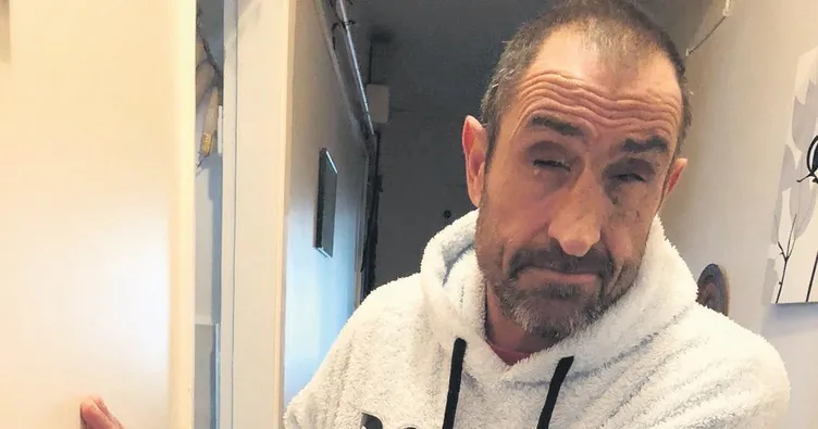 Yıldırım çarptı gözlerini kaybetti