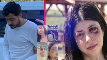 Samsun'da sokak ortasında darp skandalı! 