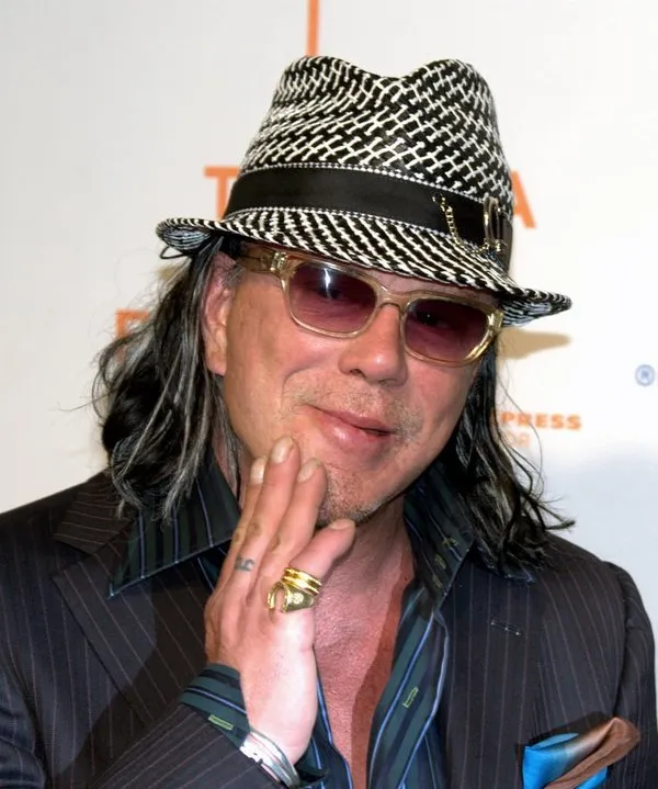 Ünlü aktör Mickey Rourke estetik operasyonların kurbanı oldu