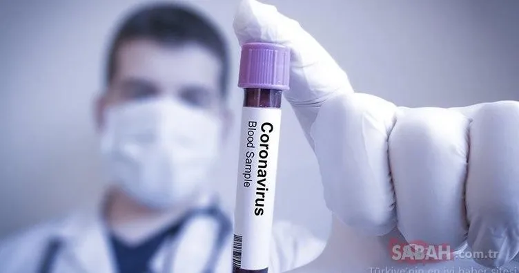 Covid 19 test sonucu kaç günde çıkar, nasıl öğrenilir? e nabız giriş ile koronavirüs test sonucu sorgulama ekranı!