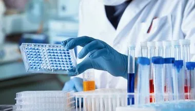 Volkan Konak'ın ölümü sonrası tartışma konusu oldu! Uzmanlar uyardı: DNA testini kimleri yaptırmalı