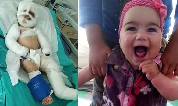 Bunun adı mucize! ‘Yaşamaz’ denilen Suriyeli Delal bebeği Türk doktorları kurtardı!