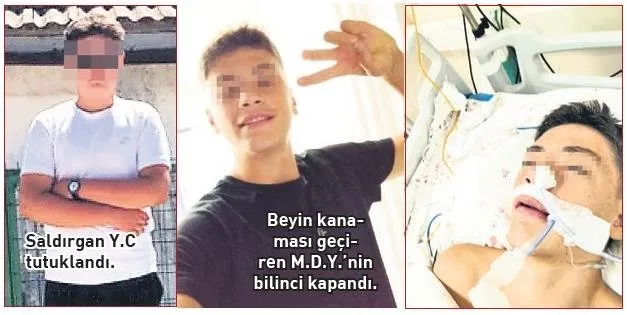 SON DAKİKA | Okulda akran dehşeti! Beyin kanaması geçirdi