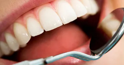 Bu ilaçla diş dolguları tarihe karışabilir
