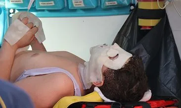 LPG istasyonunda can pazarı! Sigarayı yakmak isterken gaz patladı: 8 yaralı #denizli