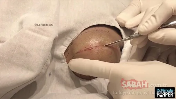 Doktora bu halde geldi! Sonrasındaysa...