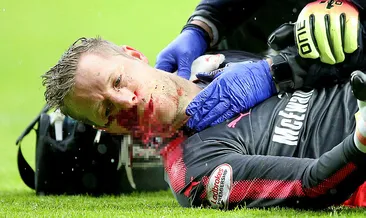 İskoçya’da yürekleri ağızlara getiren sakatlık!