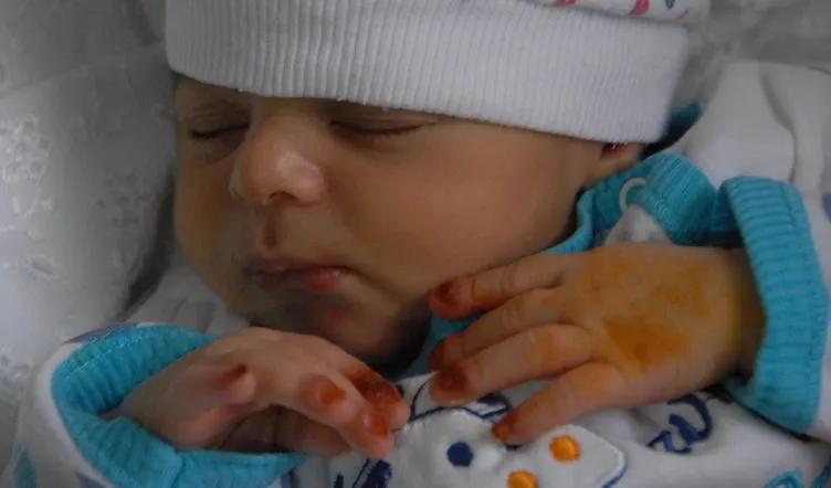 15 günlük bebeği, iki evladını kaybettiği hastalığın pençesinde