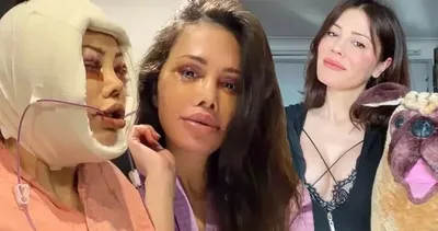 ’Hayatımın kararı’ diyerek gitti, kabusu yaşadı! Didem Ceran’ın estetik mağduriyeti pes dedirtti! Sinirlerine hakim olamadı....