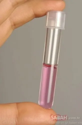 SON DAKİKA | Oğlunu ’AIDS’ virüsü nedeniyle kaybeden baba SABAH’a konuştu: Bir kez bile öpmedim!