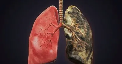 Ciğerleri temizlediği ortaya çıktı! İşte nikotini dışarı atan süper gıda