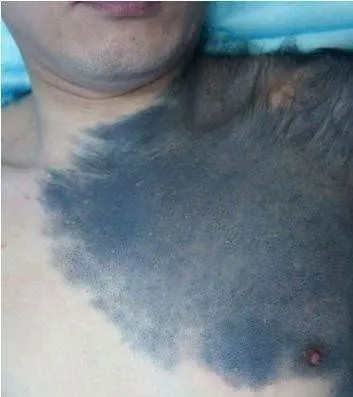 Herkes ona şempanze diyor
