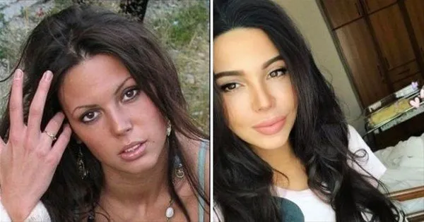 Rus kadınlarının estetikle değişimi