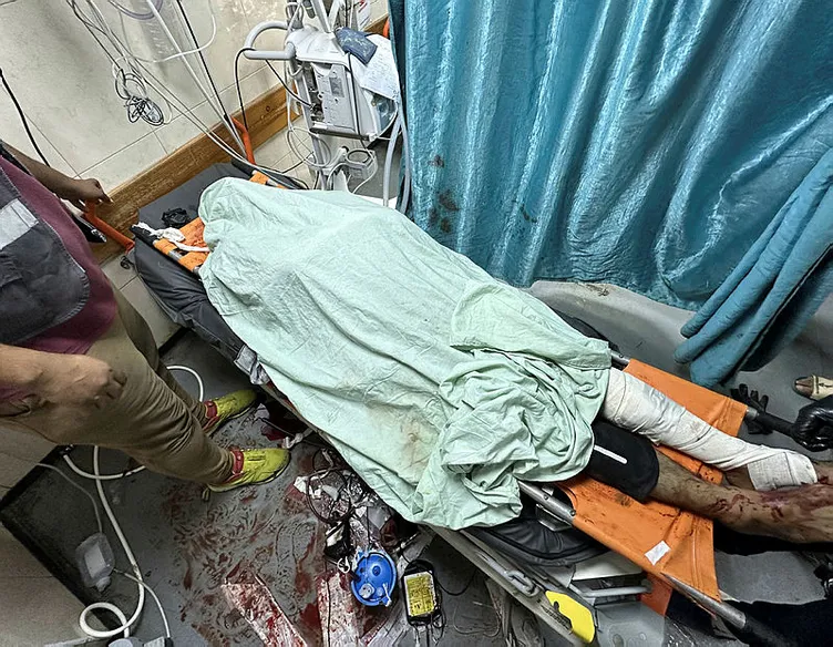 Katil İsrail’in Gazze’deki zulüm arşa ulaştı! İnsanlar ölmek için dua ediyor: Çocuklar lağım suyu içiyor