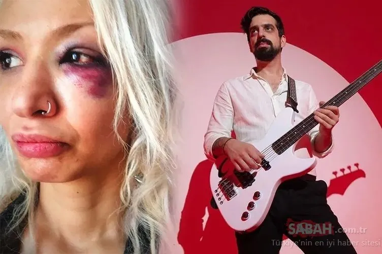 “Yüzyüzeyken Konuşuruz” solisti Can Tunaboylu’ya 1 yıl 9 ay hapis kararı! sevgilisi Aybike Çelik’i darbettiği iddiasıyla yargılanıyordu... 1 Yüzyüzeyken Konuşuruz solisti Can Tunaboylu’ya 1 yıl 9 ay hapis kararı! sevgilisi Aybike Çelik’i darbettiği iddiasıyla yargılanıyordu...