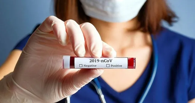 Corona Virus Nedeniyle En Cok Hemsire O Ulkede Hayatini Kaybetti Dunya Haberleri