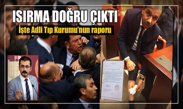Adli Tıp’ın ’ısırık raporu’ ortaya çıktı!