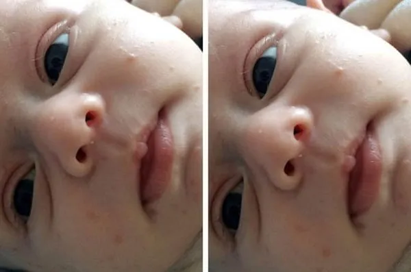 Dünya'nın en garip hastalıkları