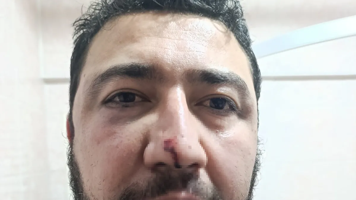 Keçiören Belediyesi’nde öldüresiye dayak skandalı! “Siz çete misiniz, organize örgüt mü?” Keçiören Belediyesi’nde öldüresiye dayak skandalı! “Siz çete misiniz, organize örgüt mü?”