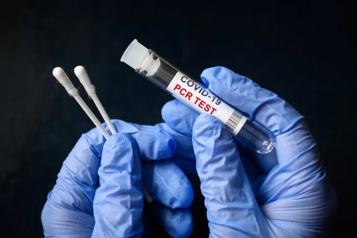 Pcr Test Sonucu Ogrenme Ekrani Pcr Testi Sonucu Ne Zaman Ve Kac Saatte Cikar Saglik Haberleri