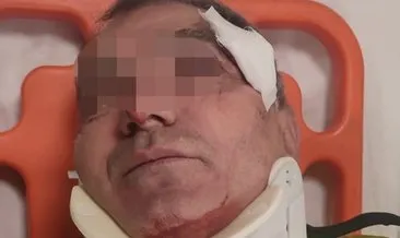 Savcılık otomobili silah saydı! Yılbaşı gecesi çarptığı polisi yaralayan magandaya 4,5 yıl istendi #konya