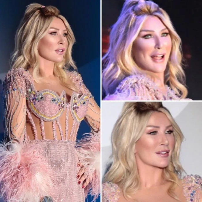 Seda Sayan estetik operasyonu sonrası ilk kez konser verdi! Galeri