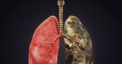 Nikotini dışarı attığı ortaya çıktı! İşte ciğerlerin temiz kalmasını sağlayan gıda...