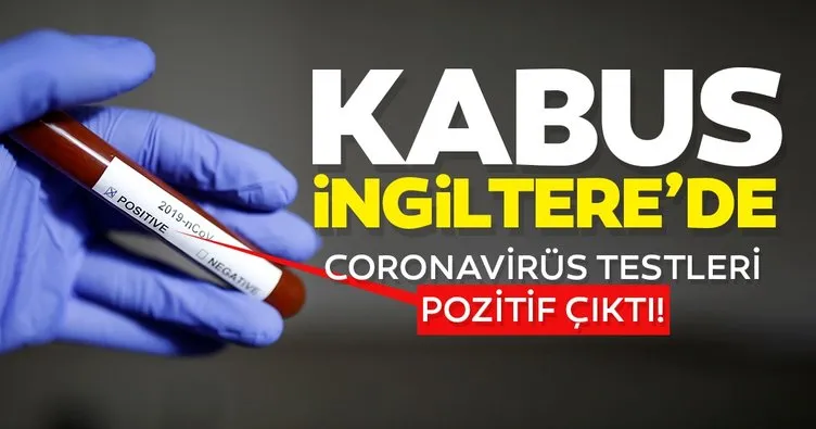 Son dakika: Kabus İngiltere’de! Coronavirüs testleri pozitif çıktı!