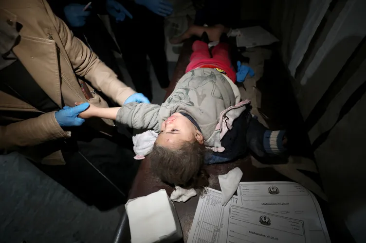 SON DAKİKA | Gazze’deki vahşetin boyutunu hastanedeki doktorlar anlattı: Yaralı çocuklar acıdan inliyordu