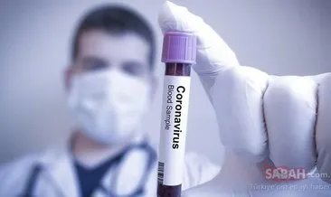 Covid 19 test sonucu kaç günde çıkar, nasıl öğrenilir? e nabız giriş ile koronavirüs test sonucu sorgulama ekranı!