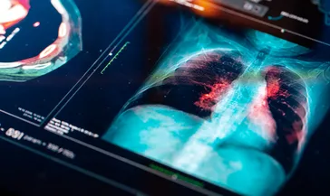 Elektronik sigara kullanımındaki korkunç tablo! Uzmanı uyardı: 5 yaşındaki çocuğun elinde gördüm