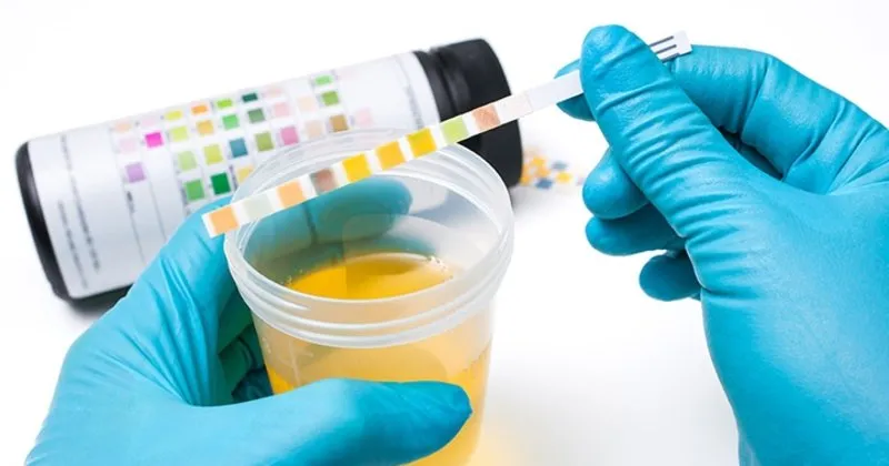 hamilelikte idrar rengi saglikli bir