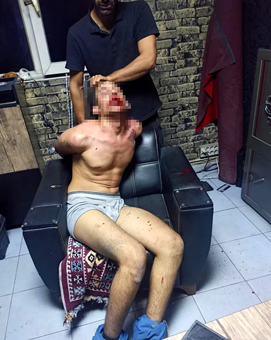 Antalya’da işçiye korkunç işkence: Üç gün dövdüler, dişlerini kırıp, böcek yedirdiler