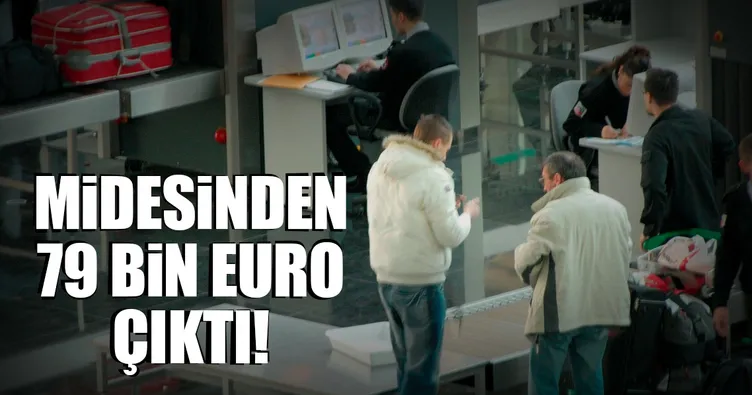 Midesinden 79 bin euro çıktı