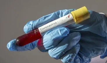 Son dakika haberi... Corona virüsü kabusu dünyaya yayılıyor! Türkiye’de de görülen corona virüsü Küba’ya da sıçradı!