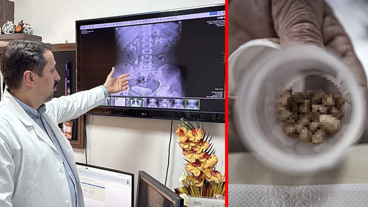 31 yaşındaki kadın yıllarca bu ağrıyla yaşadı! Ameliyata giren doktor bile şaşırdı 31 yaşındaki kadın yıllarca bu ağrıyla yaşadı! Ameliyata giren doktor bile şaşırdı