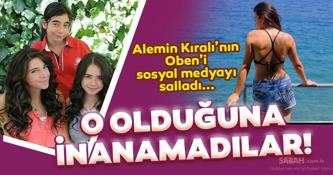 alemin kirali nin oben i birsu demir degisimi ile dudak ucuklatti oben karakteri ile unlenen birsu demir son hali ile unlu sarkiciya benzetildi galeri magazin