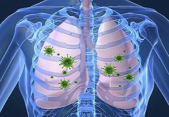 Akciğer kanseri tedavisi görenlere güzel haber