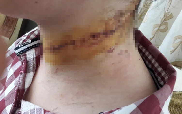 SON DAKİKA HABERİ: Eşinin boğazını kesmişti... İfadesi şoke etti!