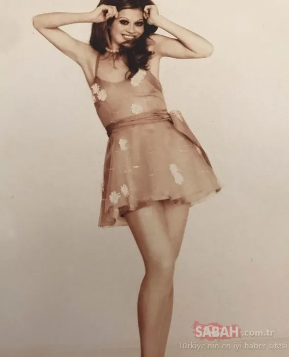 ’Bayan Bacak’ lakaplı Serpil Örümcer’den kötü haber! Yardım istedi: Ayağımın kesilme ihtimali varmış...