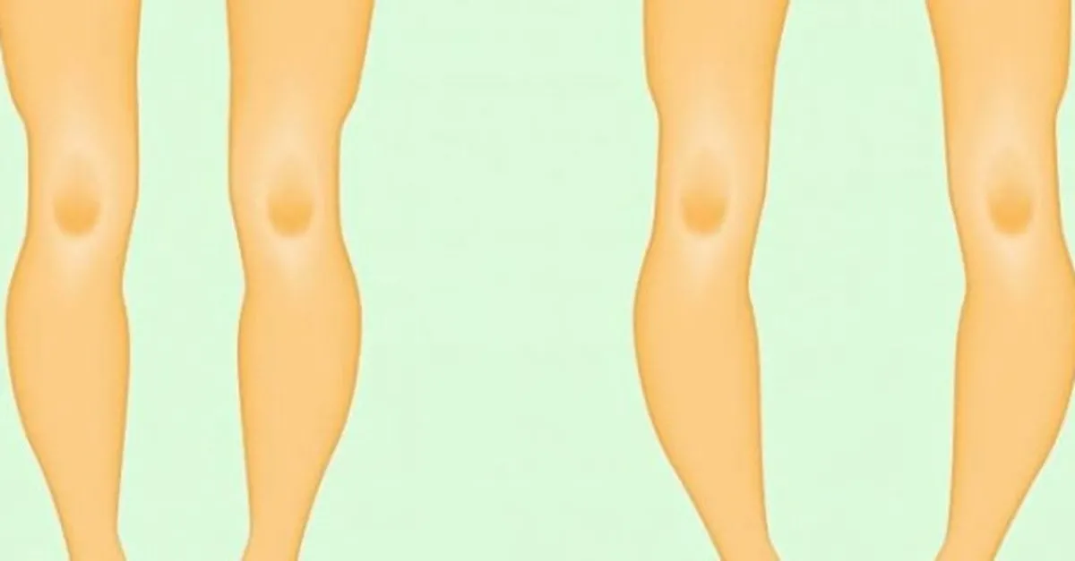 belirtileri nelerdir