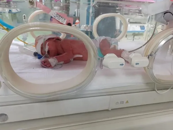 Son Dakika Haberi Doktorlar Bile Saskina Dondu Cift Rahimli Kadin Her Bir Rahminde Bebek Dunyaya Getirdi Son Dakika Haberler