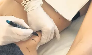 Yeni nesil zayıflama yöntemleri