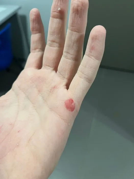 Okula giden 16 yaşındaki İhsan köpek saldırısına uğradı: Talihsiz çocuk canını zor kurtardı!