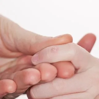 Bilimsel olarak kanıtlandı! Siğillerin kökünü kazıyor