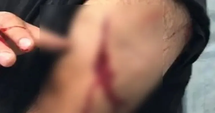 Şanlıurfa’da öğretmene jiletli saldırı