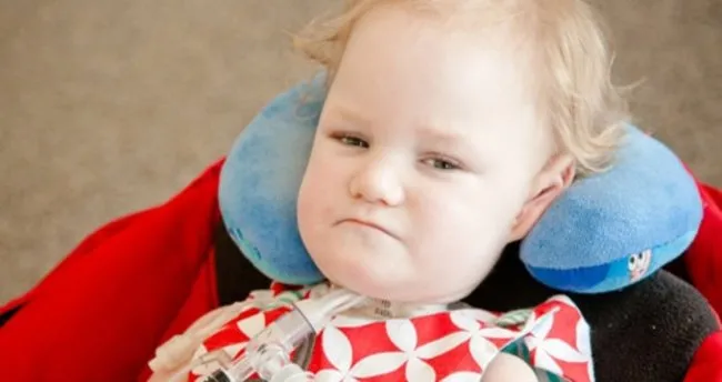 belirtileri nelerdir