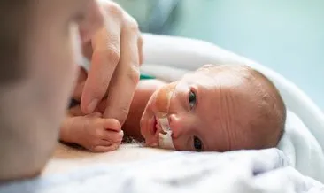 Prematüre bebek gelişiminde ilk 1 yıl takip önemli